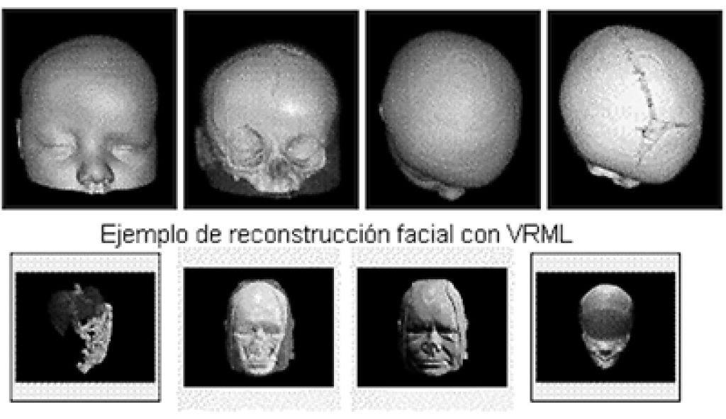 VERS (Virtual environment for reconstruction surgery)
